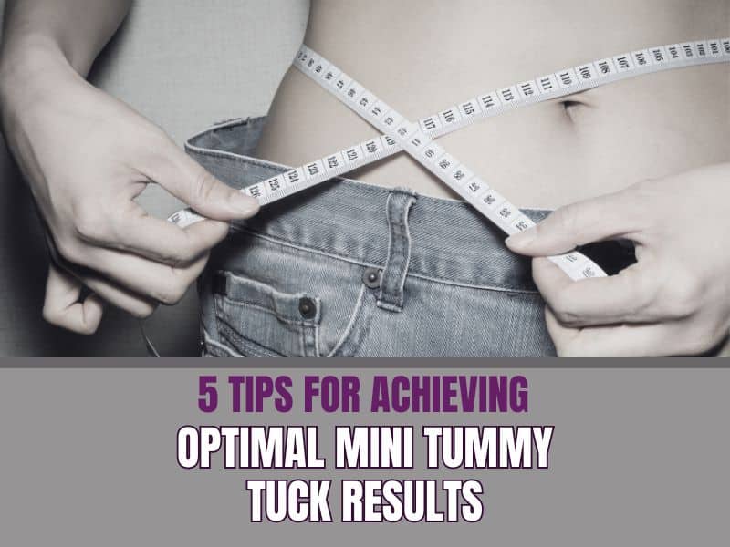 5 Tips for Achieving Optimal Mini Tummy Tuck Results