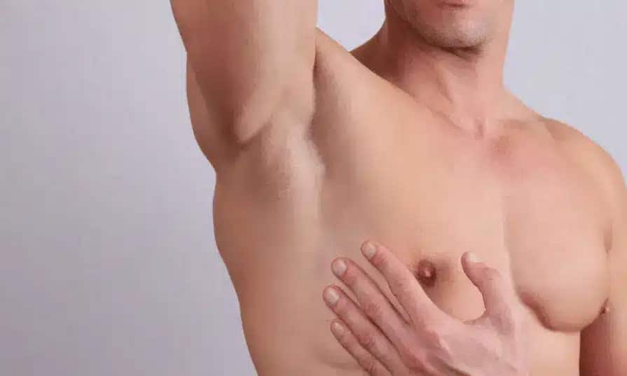 6 COMMON GYNECOMASTIA CAUSES