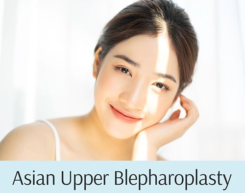 Asian upper blepharoplasty