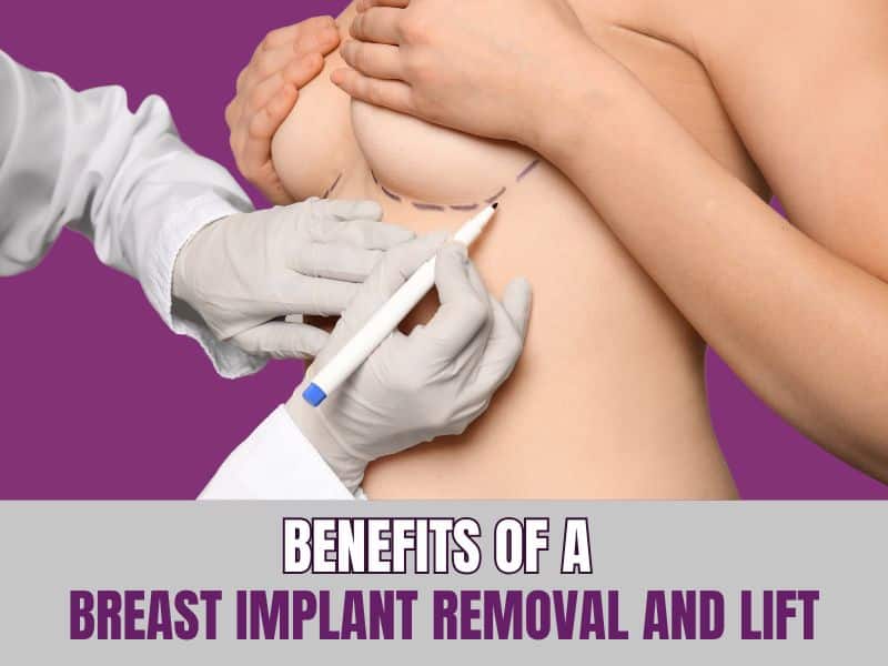 Benefits of a Breast Implant Removal and Lift