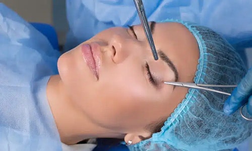 Blepharoplasty Asian