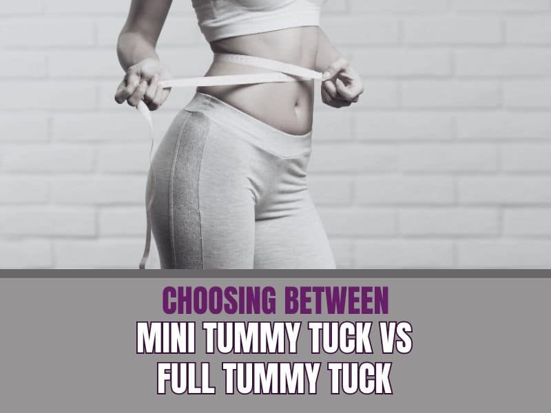 Choosing Between Mini Tummy Tuck vs Full Tummy Tuck