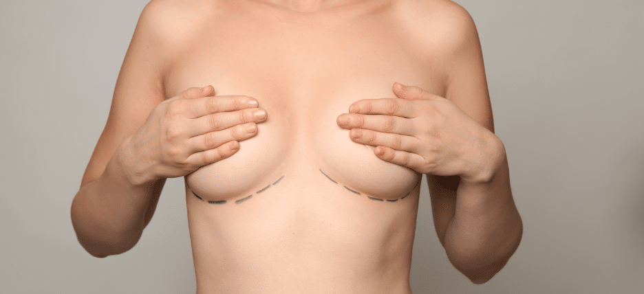 https://www.drsteinberg.com/wp-content/uploads/Does-Insurance-Cover-Breast-Implant-Removal.png