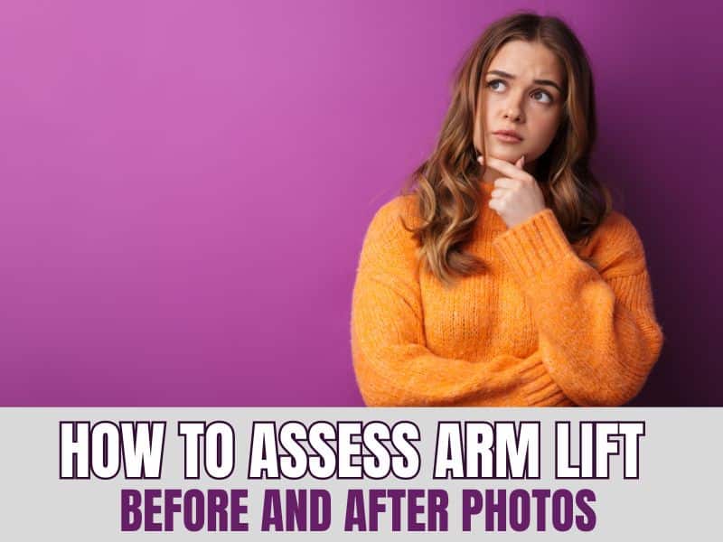 How to Assess Arm Lift Before and After Photos