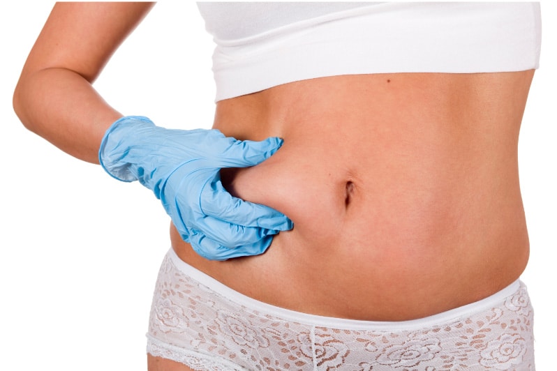 What Not to Do After Liposuction During the First Week and Beyond