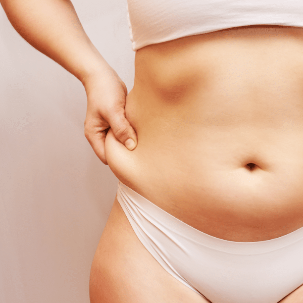 What Is a Mini Tummy Tuck & How Does It Work?