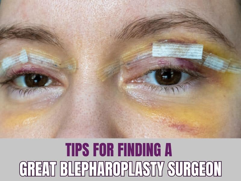 Tips for Finding a Great Blepharoplasty Surgeon