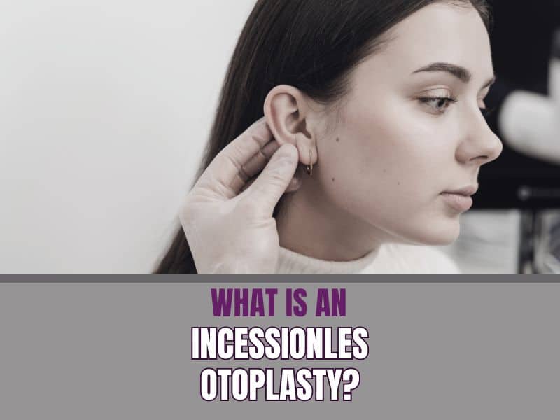 What Is an Incisionless Otoplasty