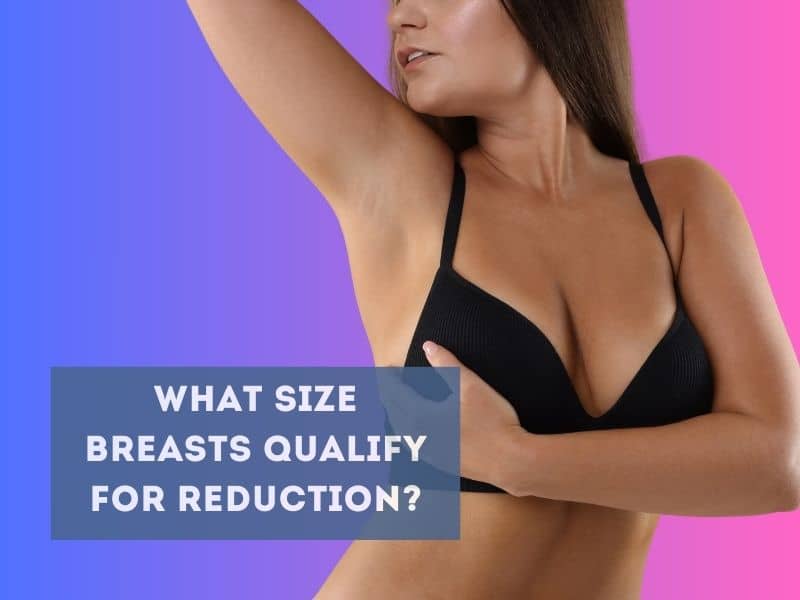 What size breasts qualify for reduction