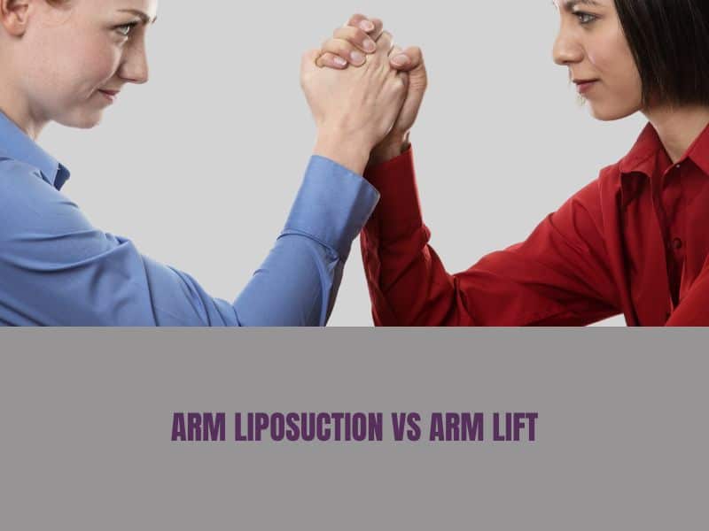 arm liposuction vs arm lift