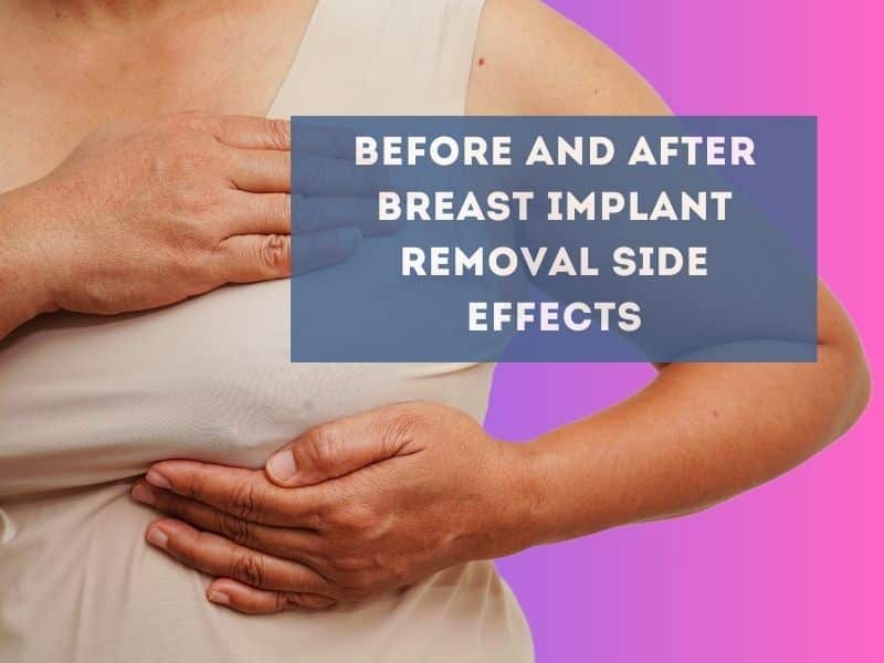 before and after breast implant removal side effects