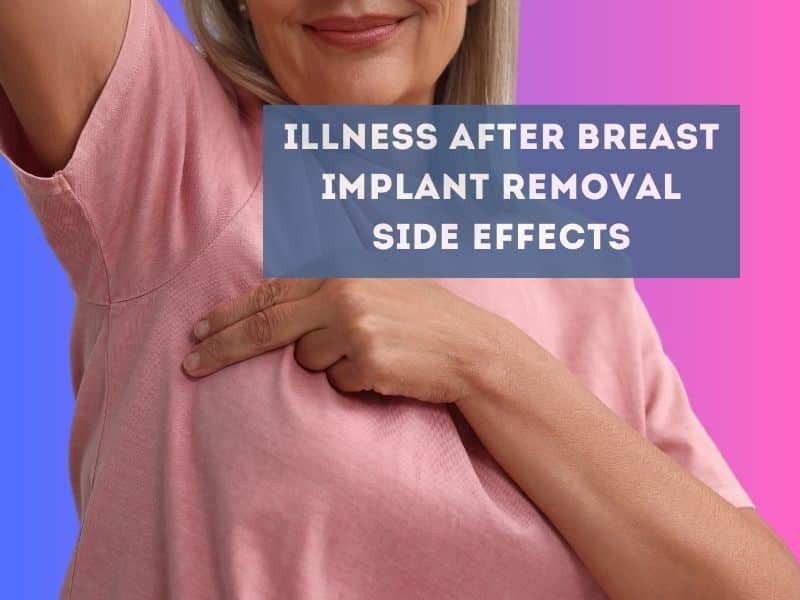 illness after breast implant removal side effects